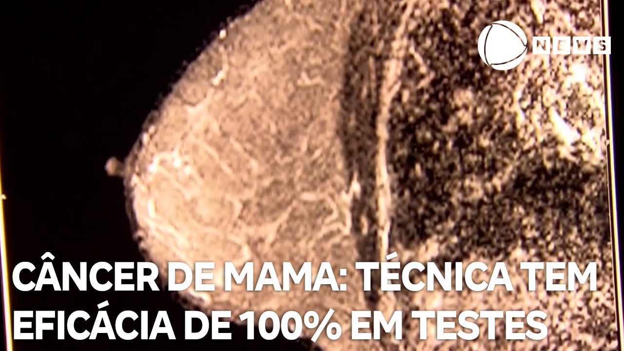 Câncer de mama: técnica de congelamento tem eficácia de 100% em testes