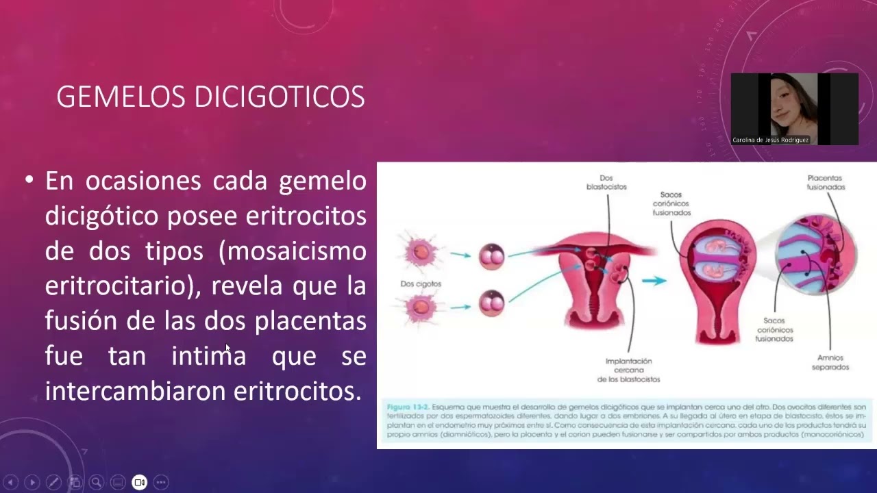 EMBARAZO MULTIPLE