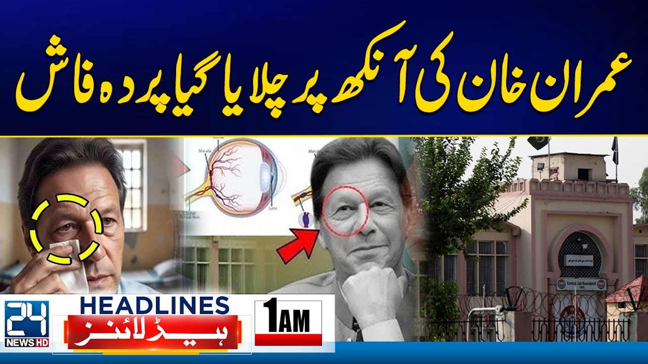 Imran Khan’s Eye Truth Finally Revealed - Imran Khan Health Updates -1am News Headlines - 24 News HD