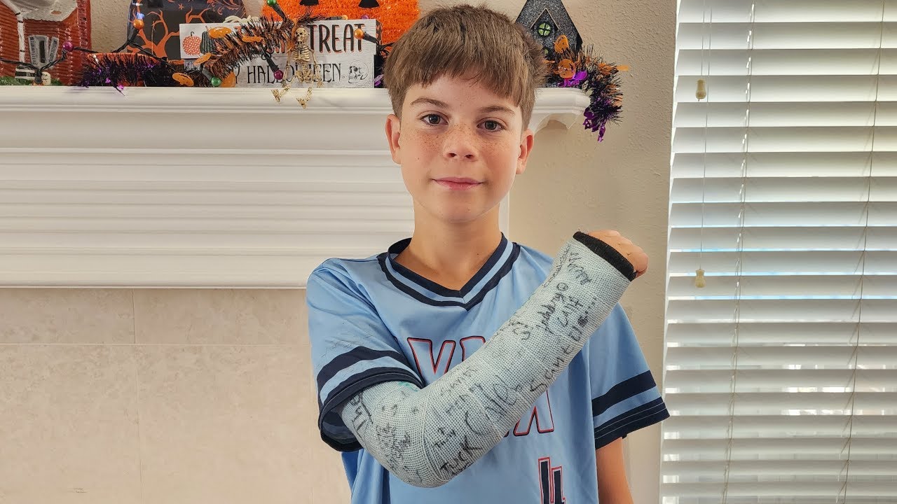 Cast Troubles - I Am Not Left-Handed
