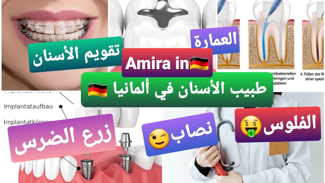 تجربتي الفاشلة مع طبيب الأسنان في ألمانيا 😭/ شنو تخلص لي التأمين شنو لي لا 😯/ الفرق بين هنا والمغرب