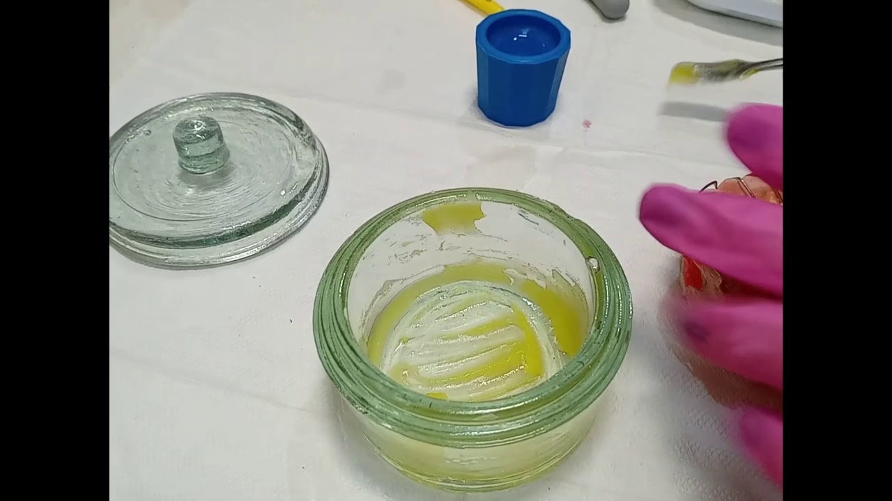 Mantenedor De Espaço Removível. Etapas com delimitação, fixação, acrilizacão e acabamento...