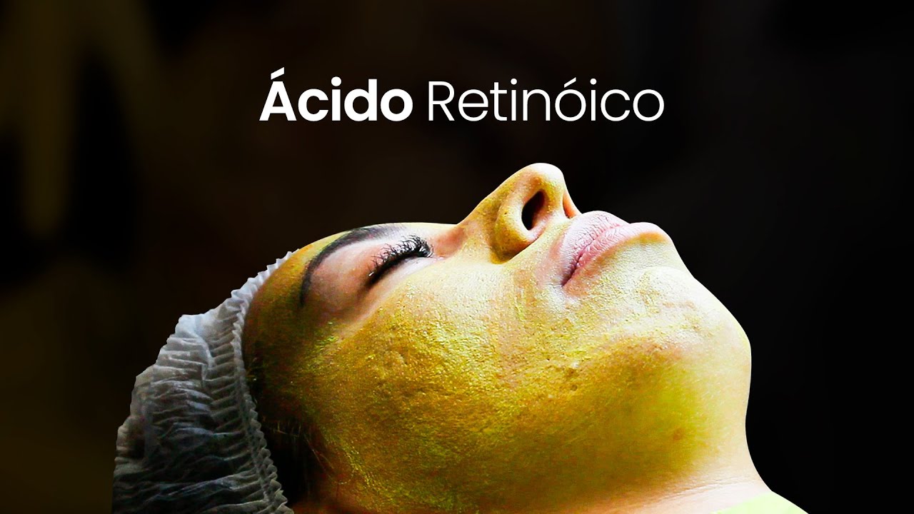 COMO É REALIZADO A APLICAÇÃO DE ÁCIDO RETINÓICO?