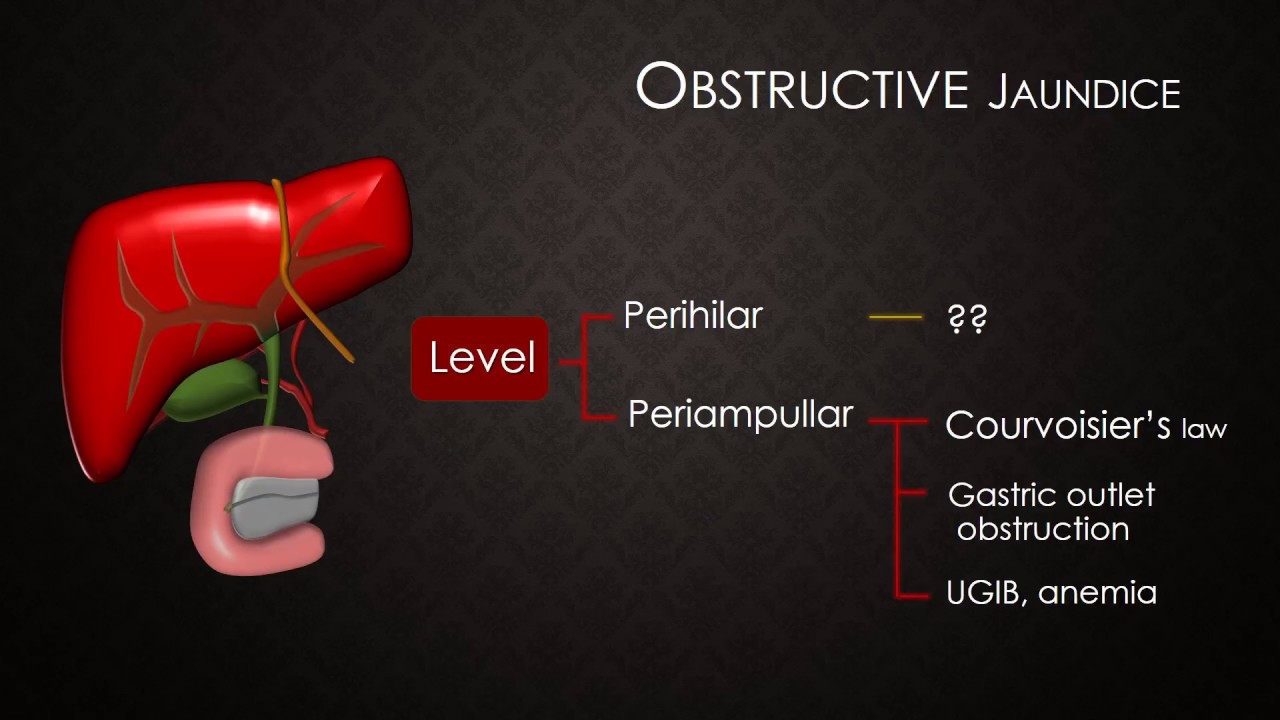 Obstructive Jaundice : Thinking Concept (THAI)