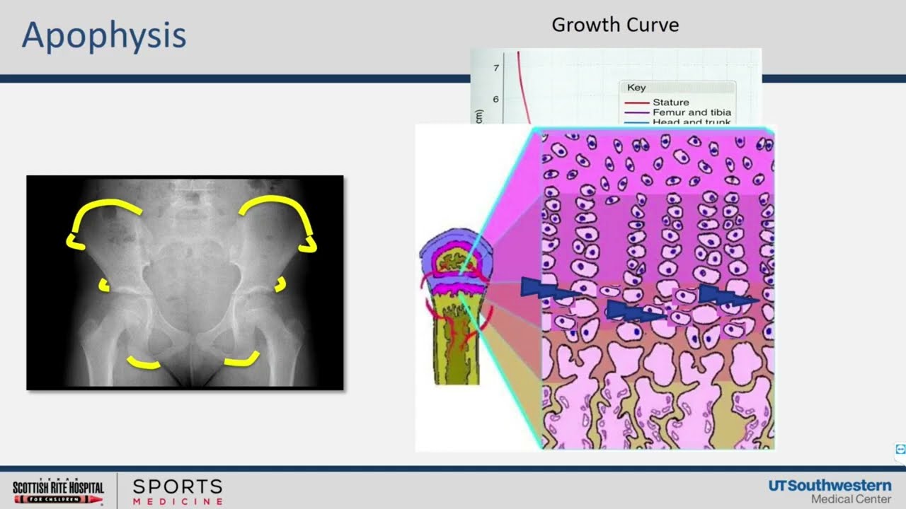 Hip and Pelvis Apophysitis