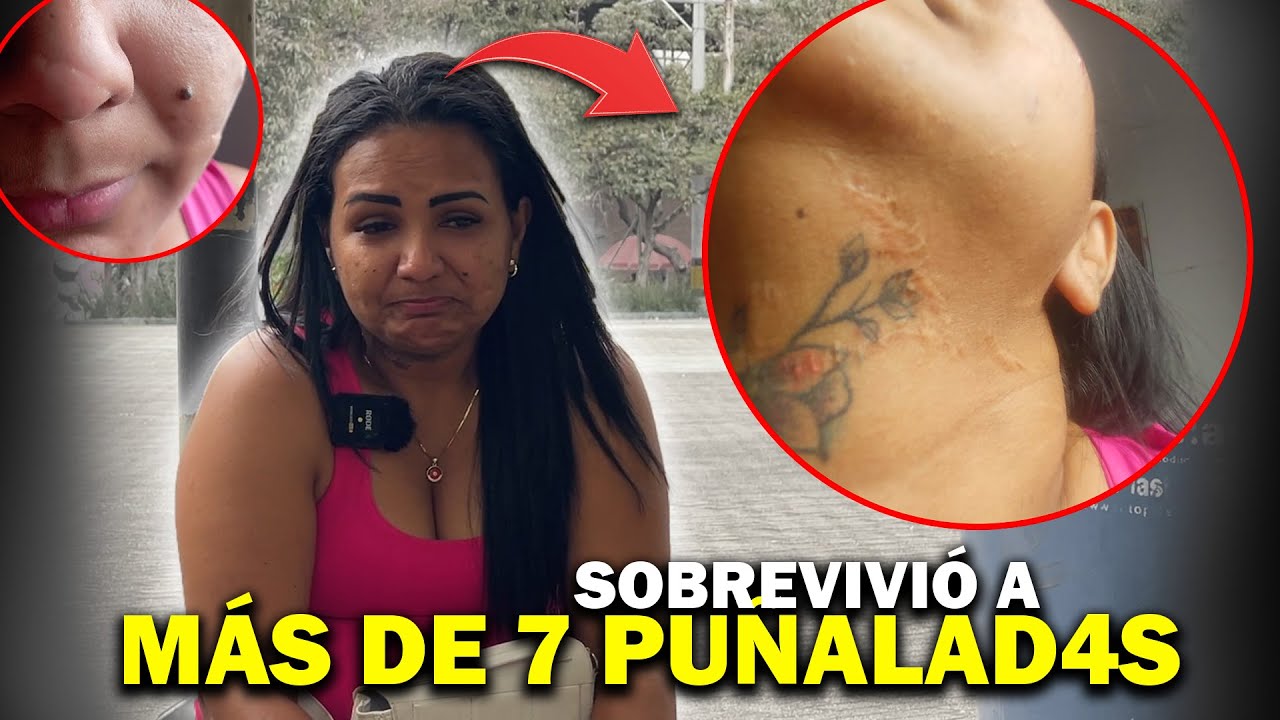 El SOBREVIVIR de MILAGRO 😨 Su ex PAREJA SENTIMENTAL la dejo marcada por siempre