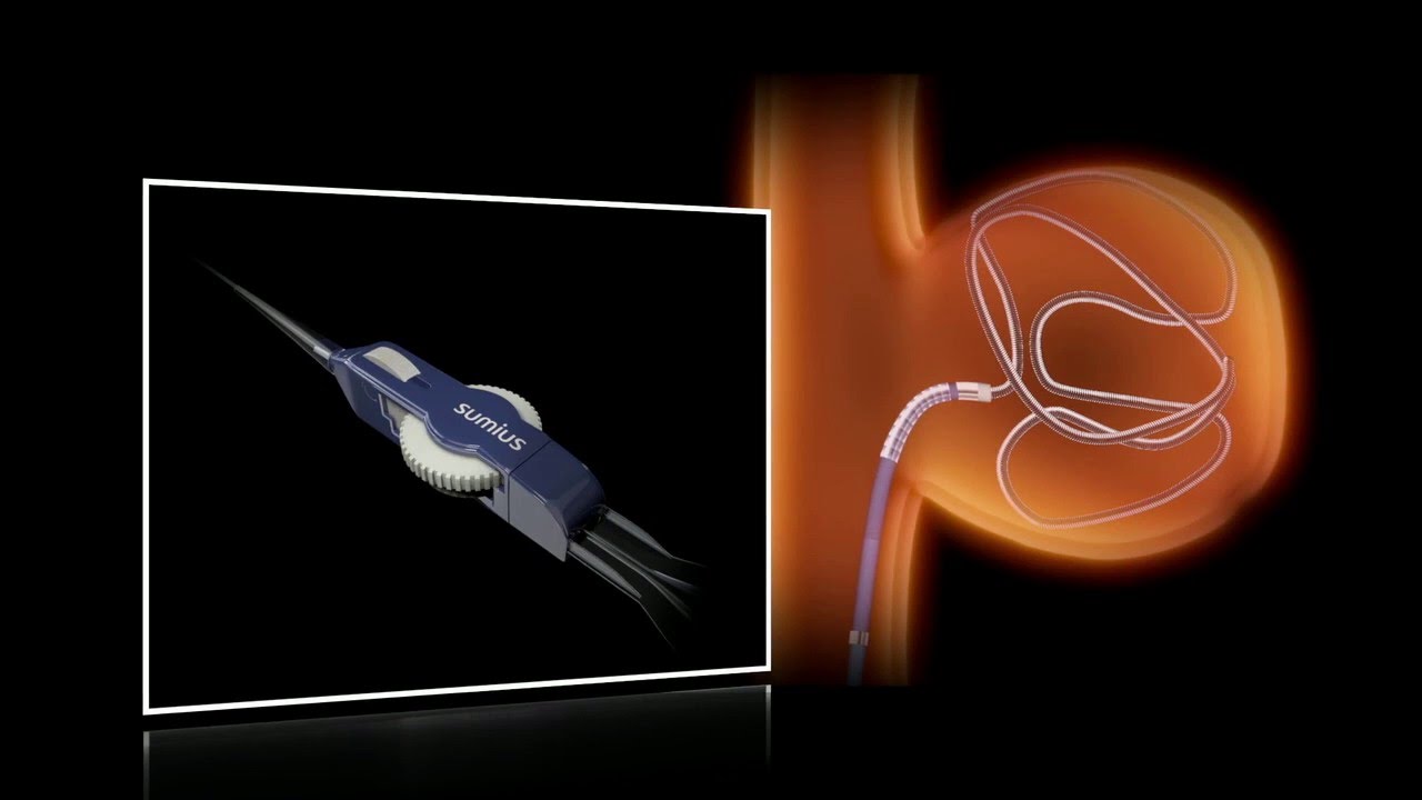 SwiftNinja&reg;  Steerable Microcatheter