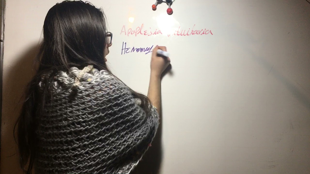 Apoplej&iacute;a Pituitaria. Endocrino