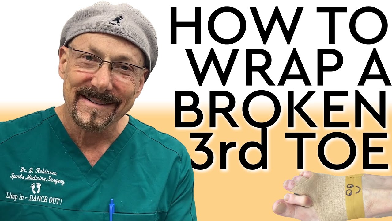 How To Wrap A Broken 3rd Toe