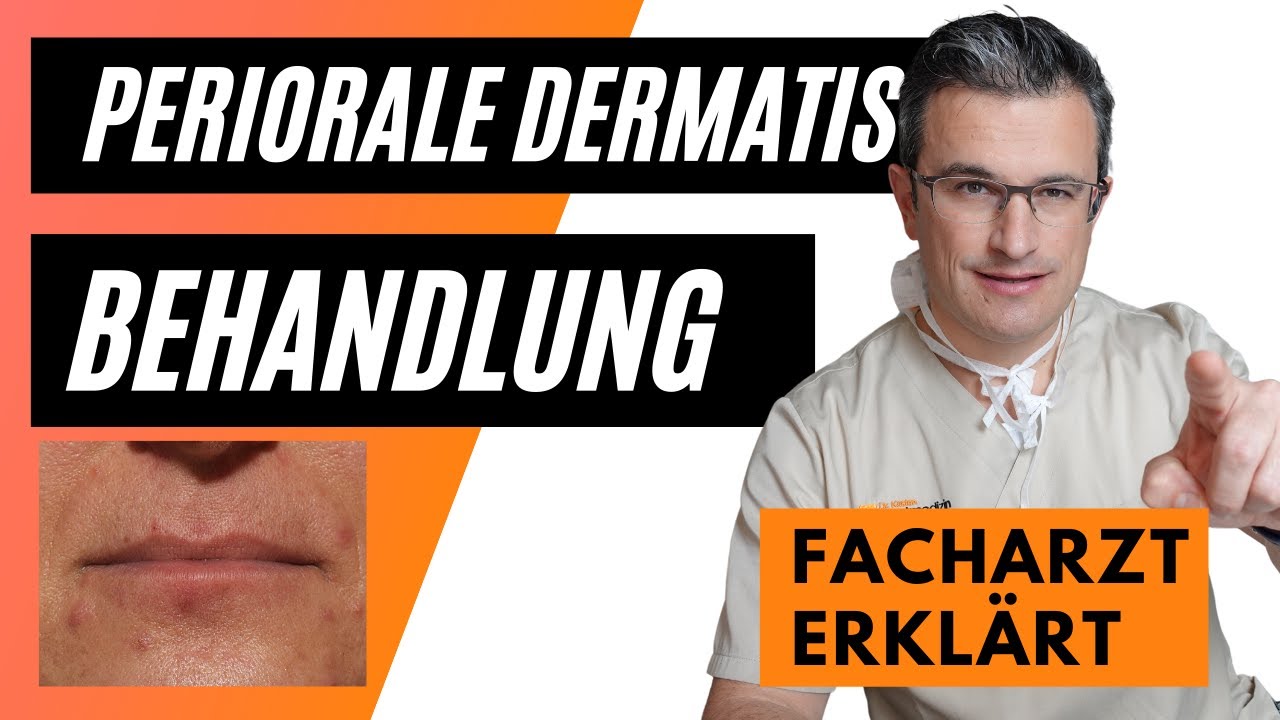 Periorale Dermatitis: Behandlung, Pflege, Make up, Nulltherapie #perioraledermatitisbehandlung