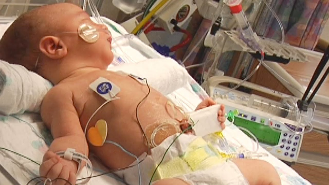 Delivery and Newborn Care for Hypoplastic Left Heart Syndrome - HLHS (3 of 5))