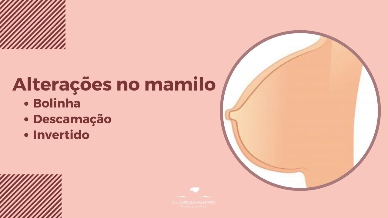 Alterações no mamilo