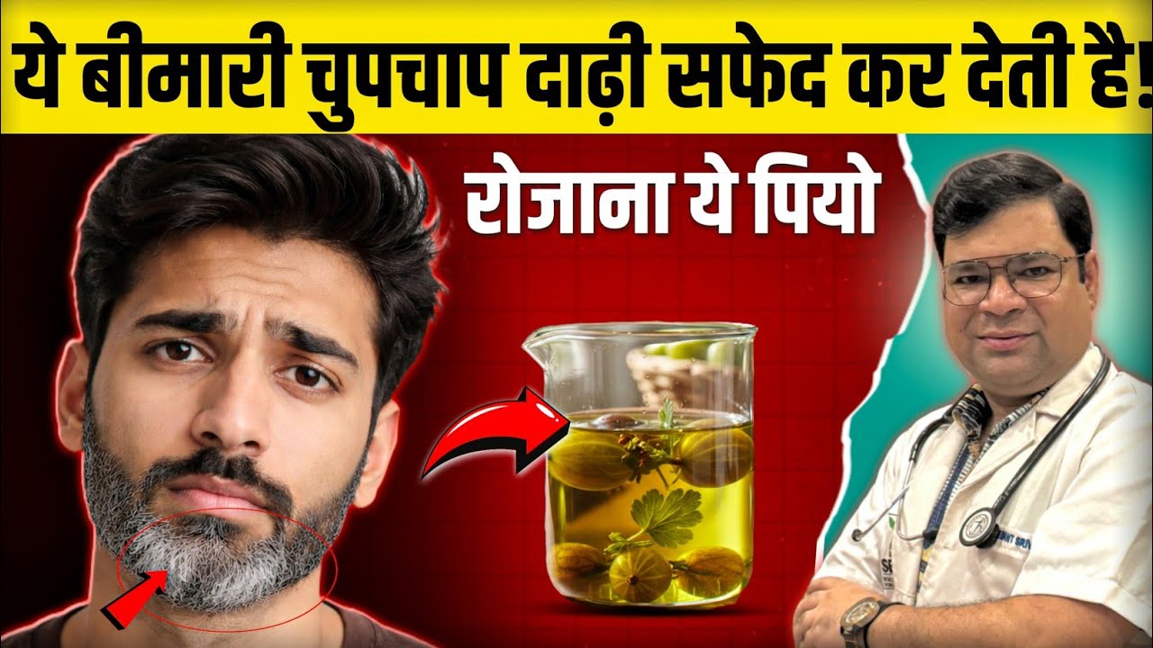 दाढ़ी सफेद हो रही है? कहीं ये बीमारी तो नहीं ! |  Safed Dadhi ko Kala karne ke nuskhe| #whitebeard 