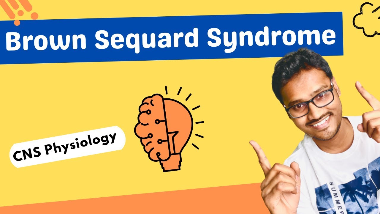 Brown Sequard Syndrome