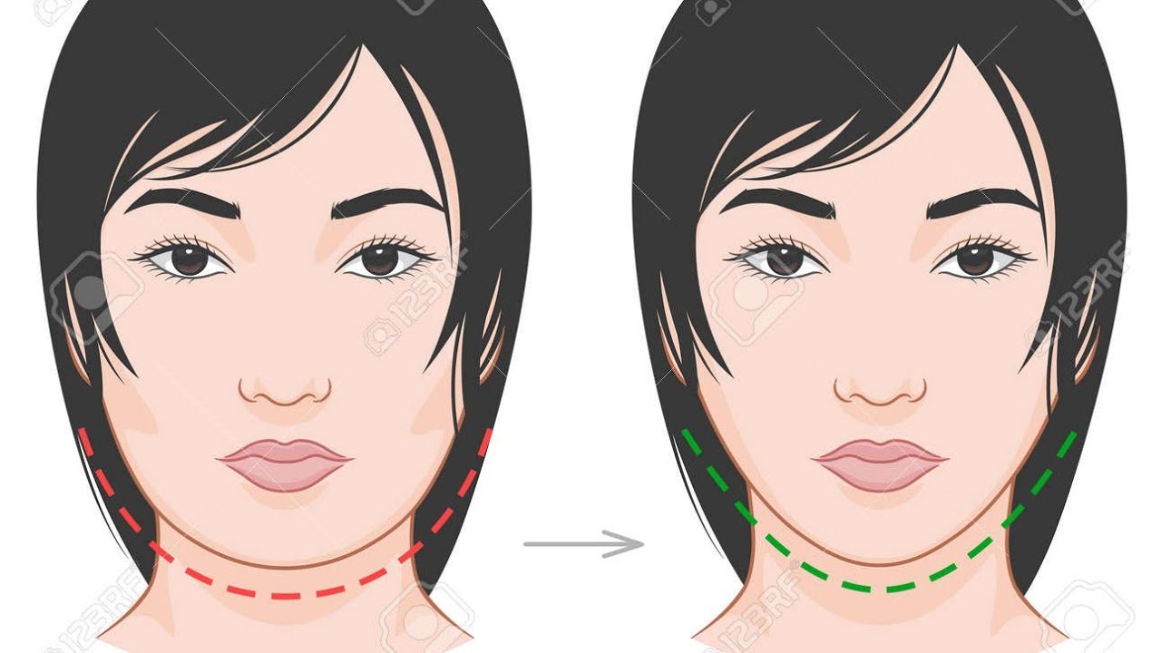 ♡: cheekbone reduction effect
