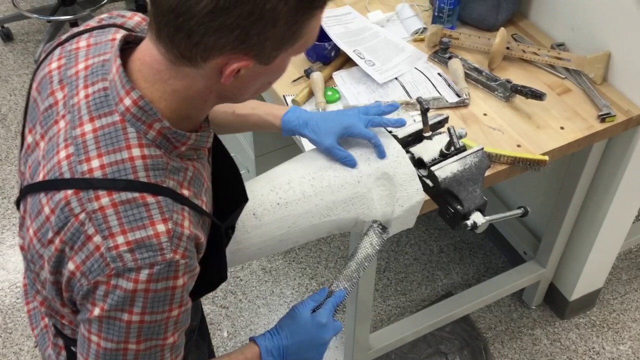 Transfemoral Cast Modification Part 2