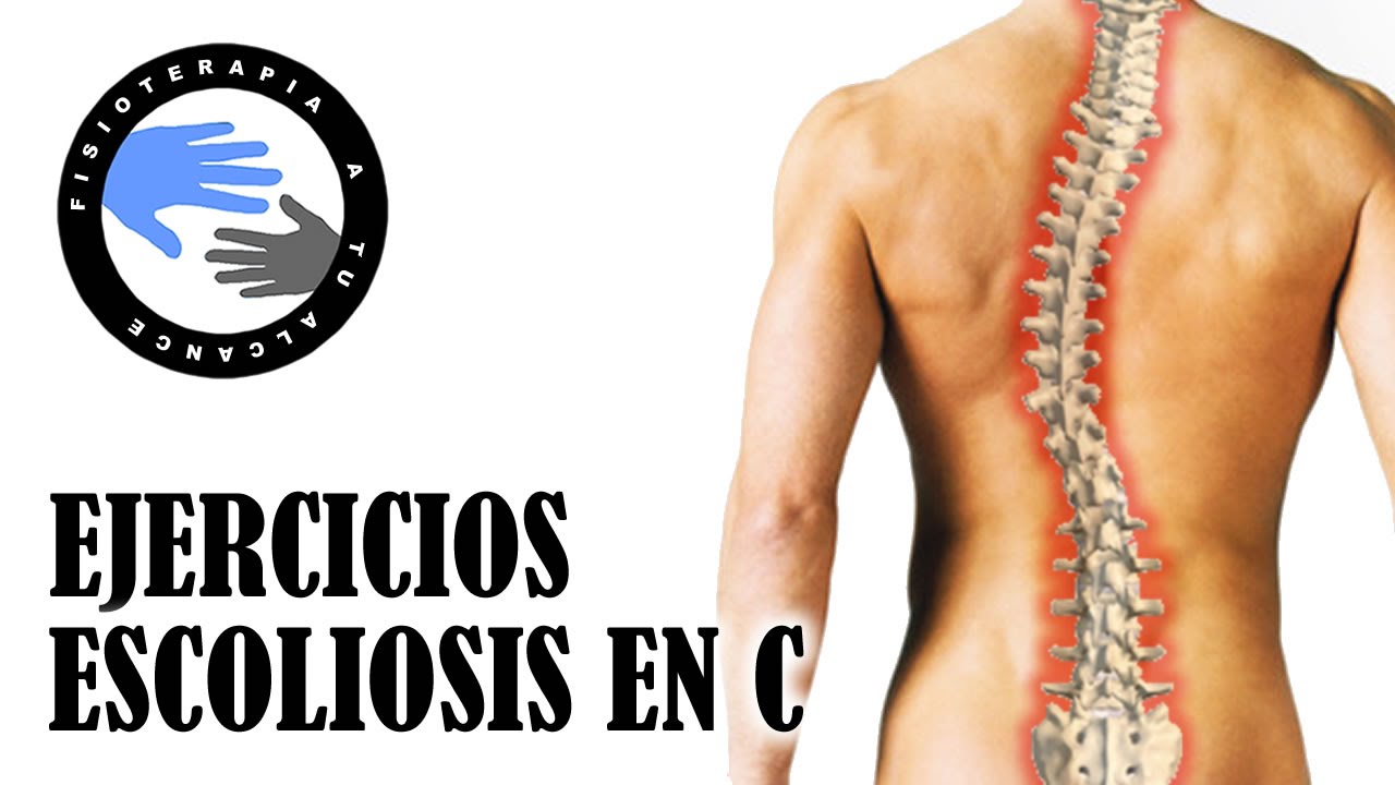 Escoliosis en C, ejercicios correctivos