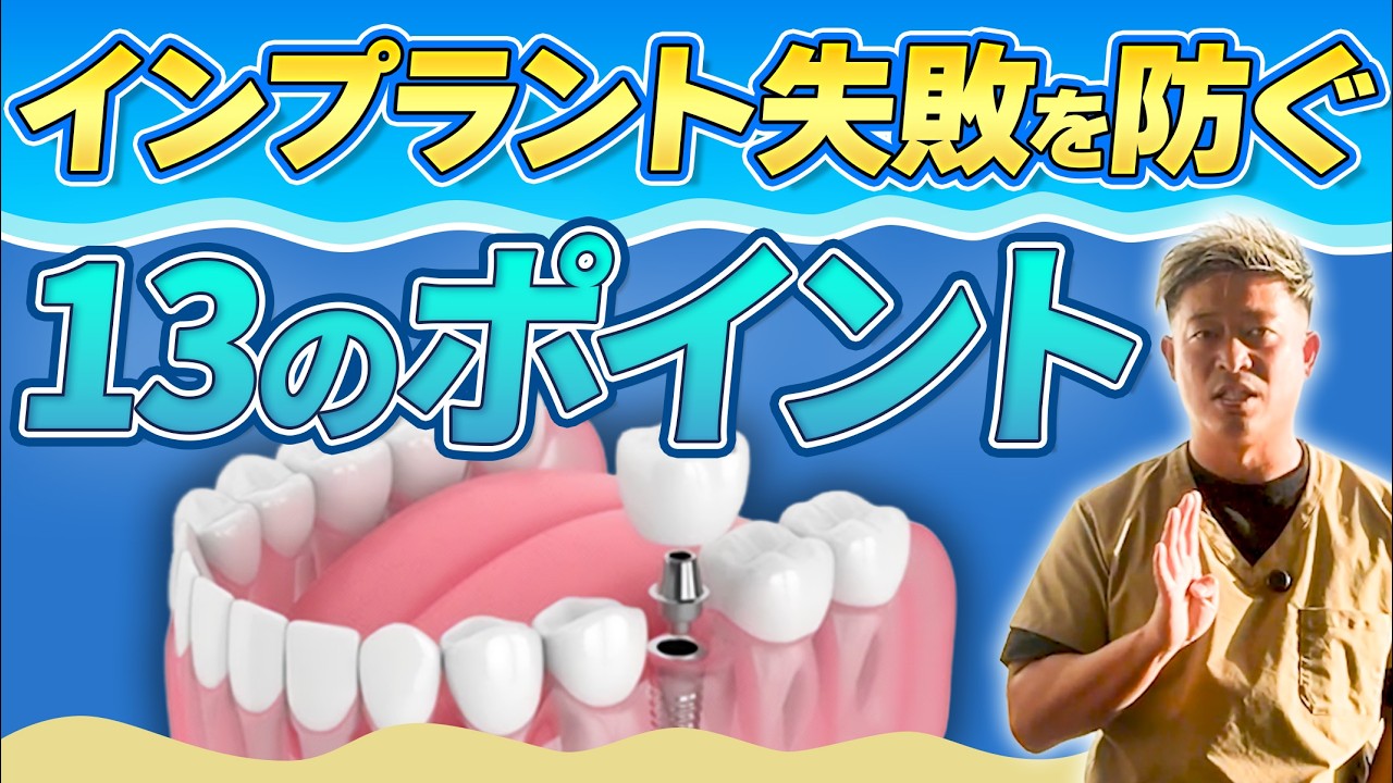 インプラントで失敗しないための13のポイント｜よくある疑問を歯科医が徹底解説！