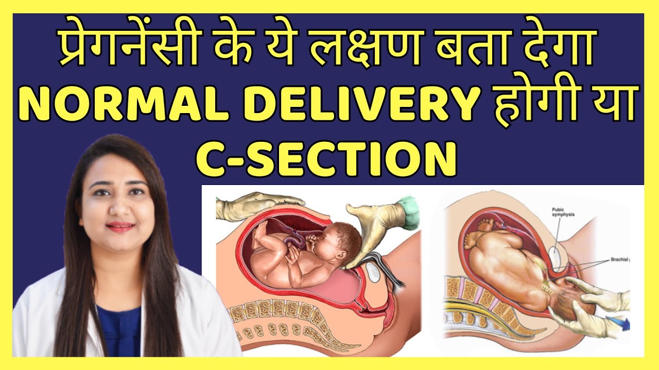 प्रेगनेंसी के ये लक्षण बता देगा NORMAL DELIVERY होगी या C-SECTION
