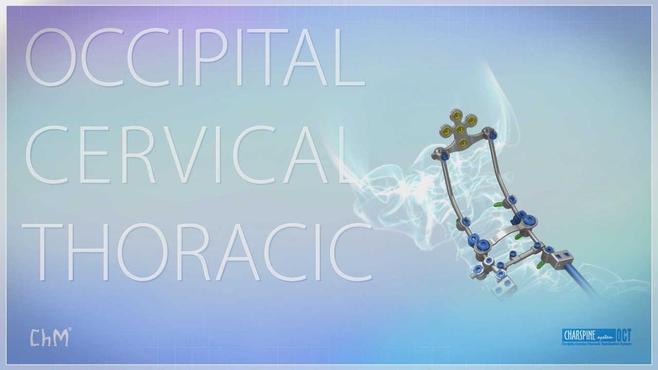 CHARSPINE OCT - system for occipito-cervico-thoracic spinestabilization