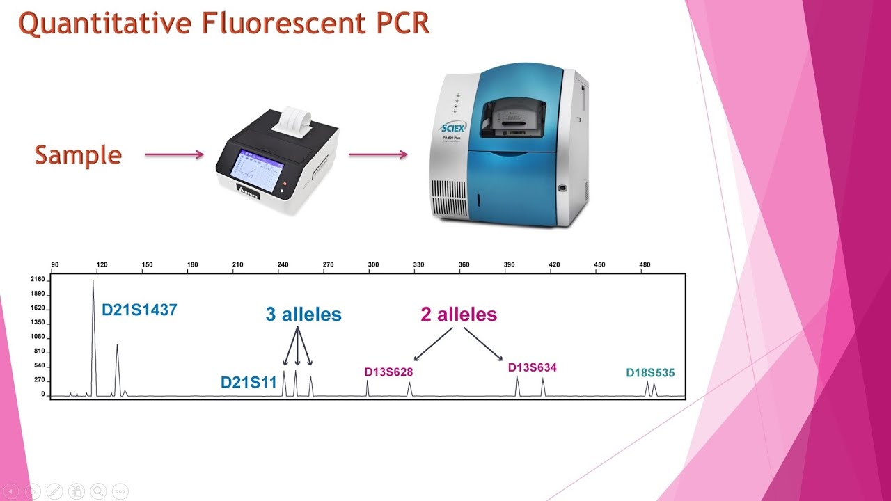 شرح کامل تکنیک QF-PCR در زمینه ژنتیک مولکولی و پزشکی