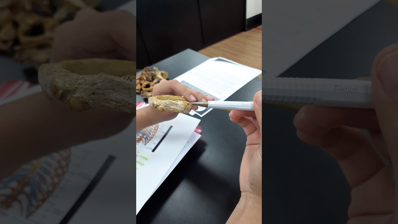 Osso costela - acidentes anatômicos