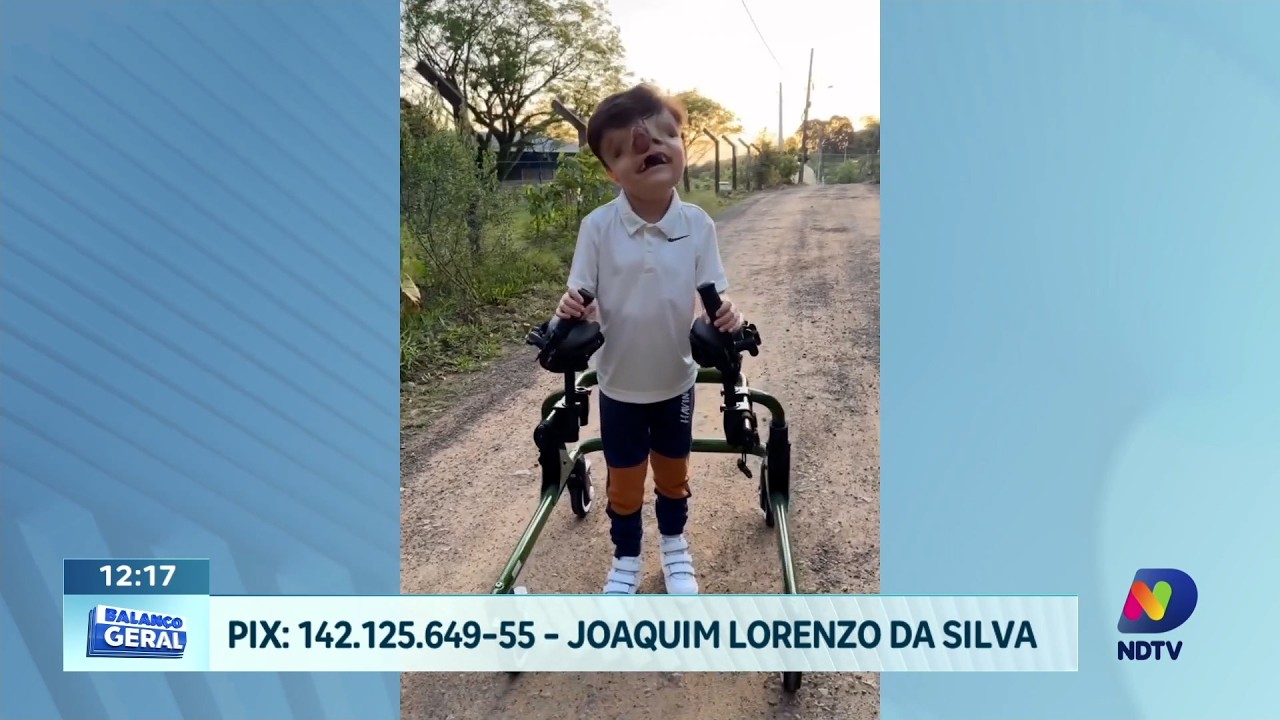 Família de Concórdia pede apoio para cirurgia de menino com doença rara