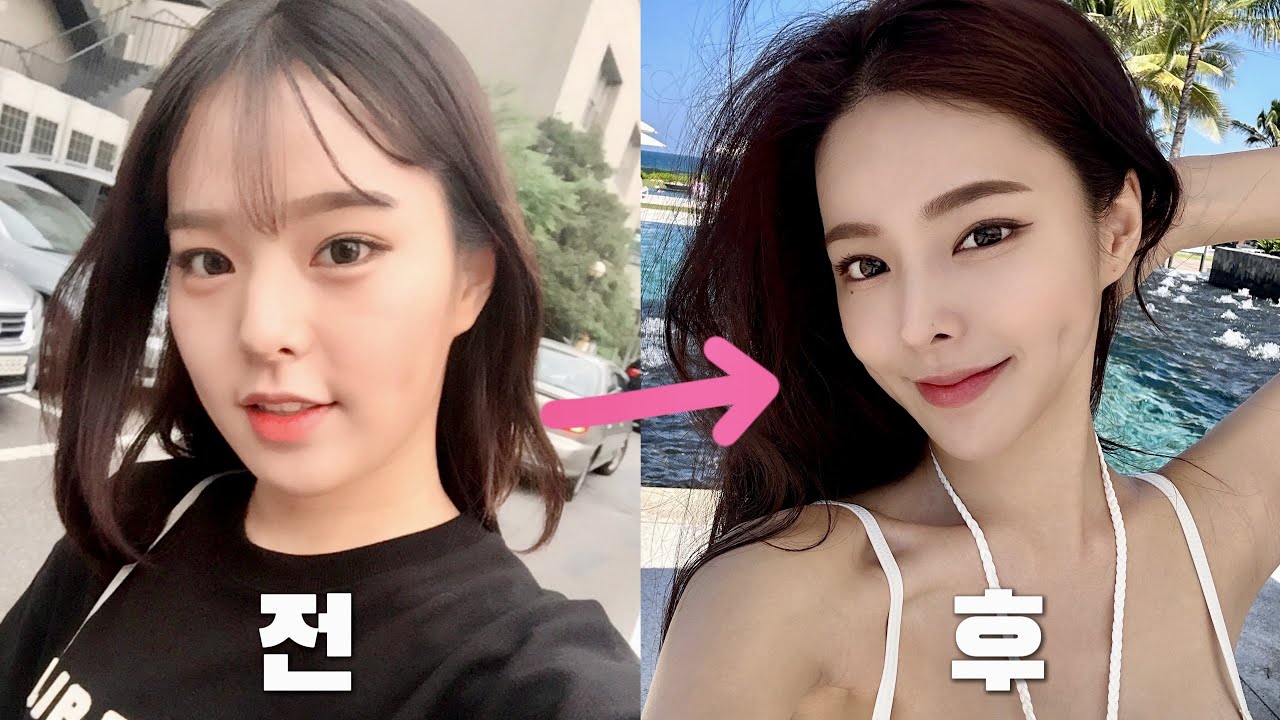 7년 전부터 지금까지 성형하며 생겼던 웃겼던 썰 풉니다,,, 총총 (feat. 회복실에서 거즈에 있던 물 짜먹음💧)
