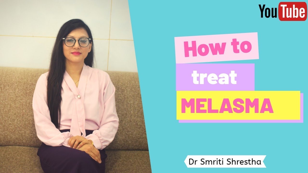 HOW TO TREAT MELASMA!!!