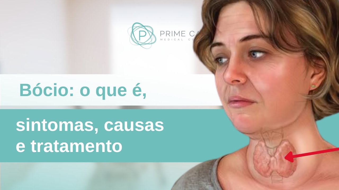 Bócios e outras alterações anatômicas e funcionais da Tireoide | Dr. Arthur Vicentini