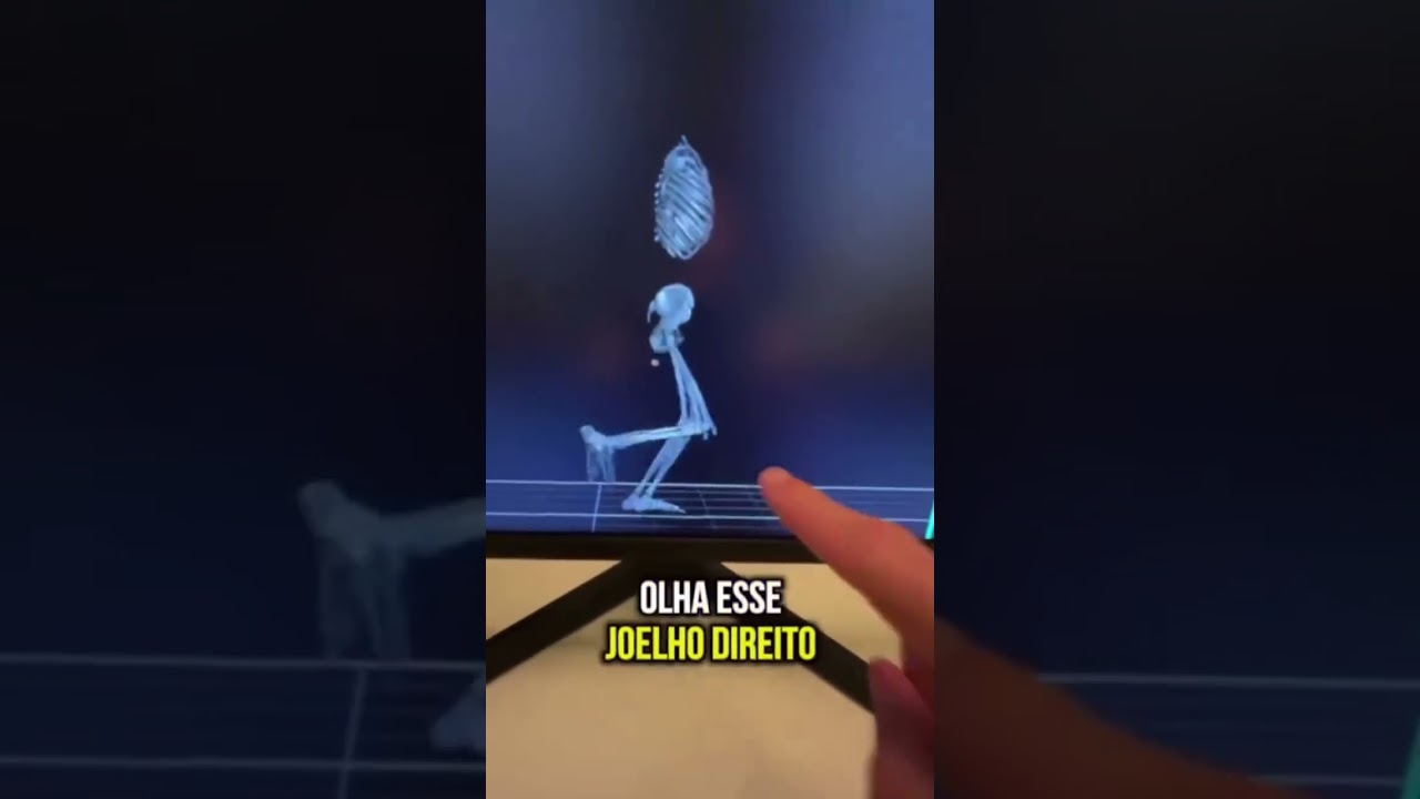Seu paciente fortalece o quadríceps, mas a dor no joelho sempre volta na corrida?