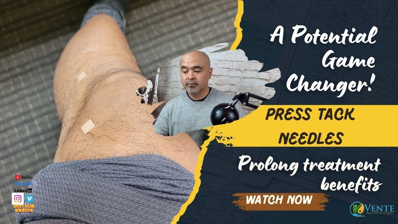 Prolong Treatment Benefits: Press Tack Needles