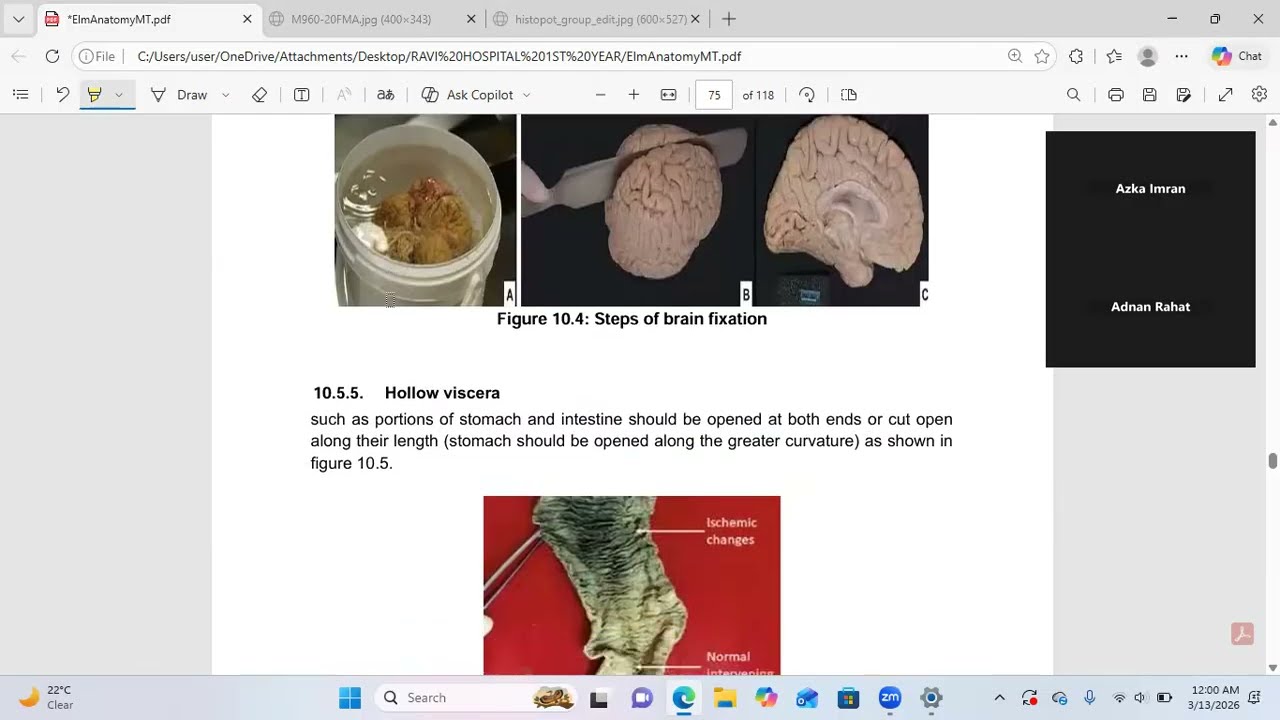 Chapter 10 (Part 2):Introduction to Microtechniques |Elementary Anatomy & Micro Techniques | PMF MLT