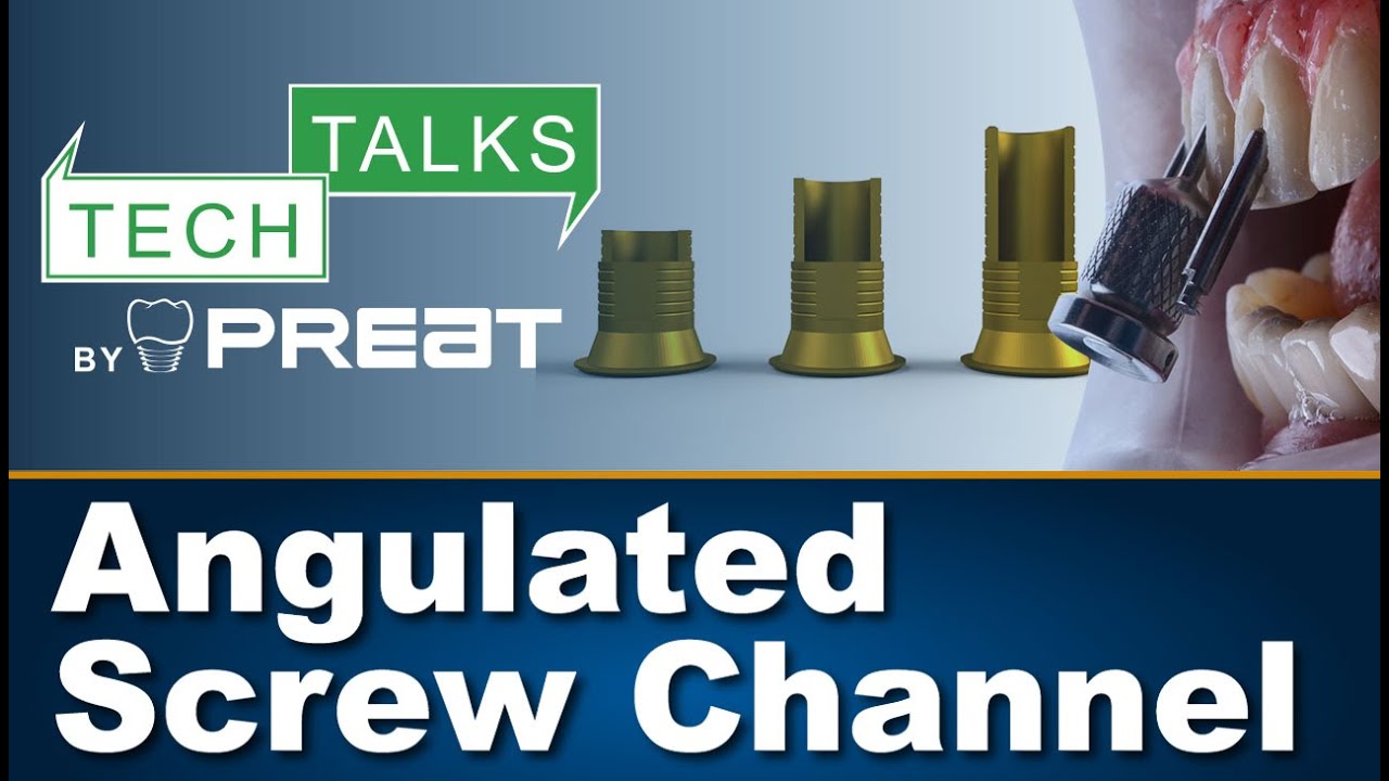 Angulated Screw Channel - Tech Talks By PREAT