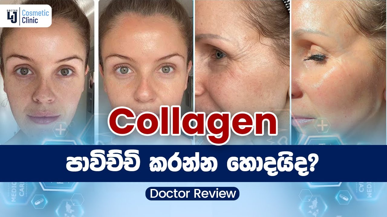 කොලජන් පාවිච්චි කරන්න හොදයිද?
