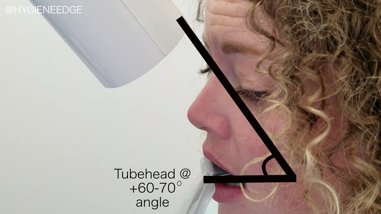Anterior PA Trick (No Holder Needed)