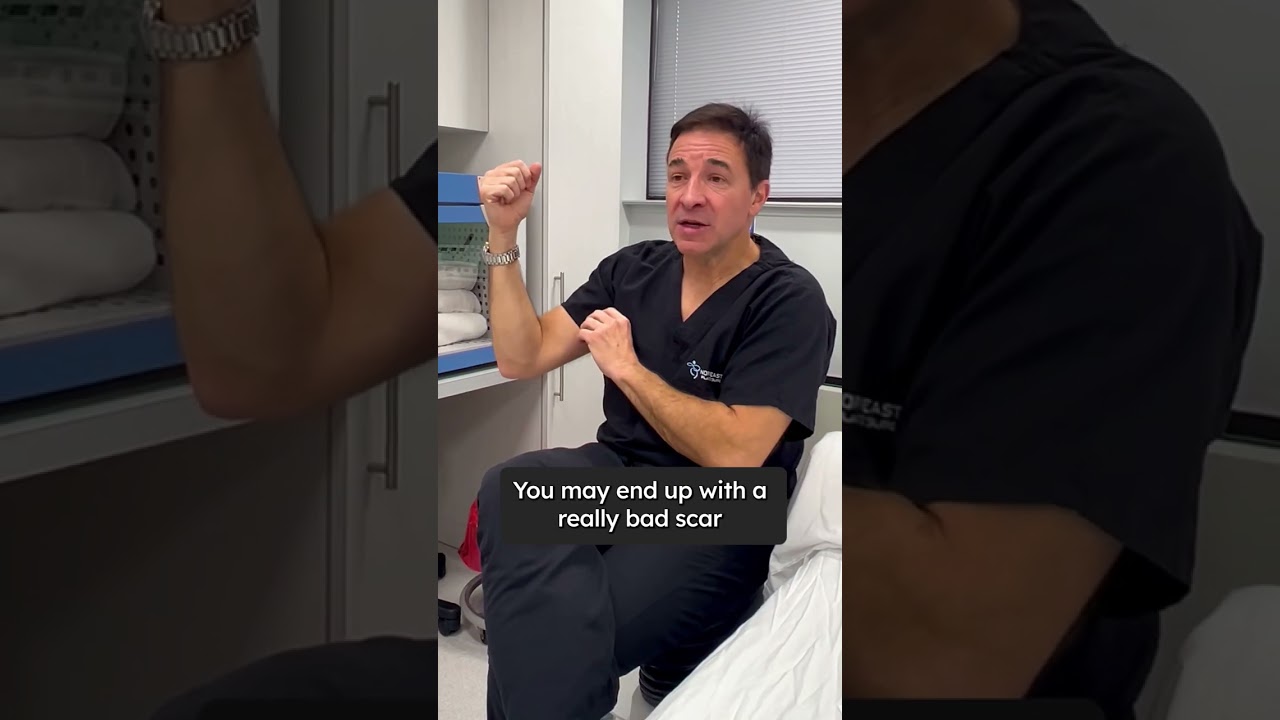 Brachioplasty (Arm Lift)