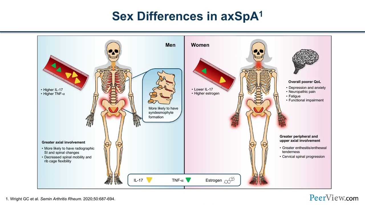 Recognition and Management of Axial Spondyloarthritis: Best Practices for Family Medicine Physicians
