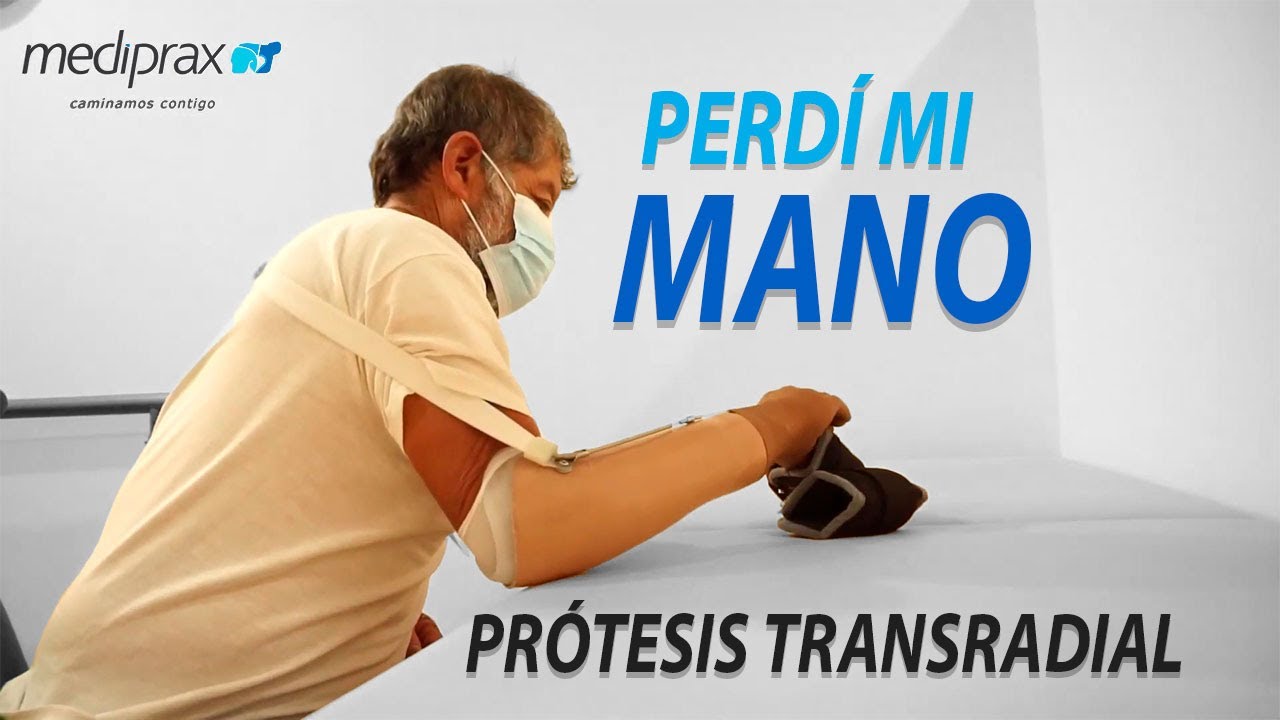 ¡Perdí mi MANO con una PICADORA  PRÓTESIS TRANSRADIAL Hermelo Mejía