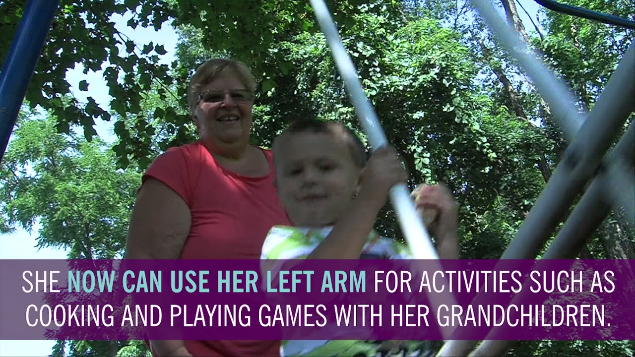 Deep Brain Stimulation Helps Woman Regain Use of Her Arm After Stroke