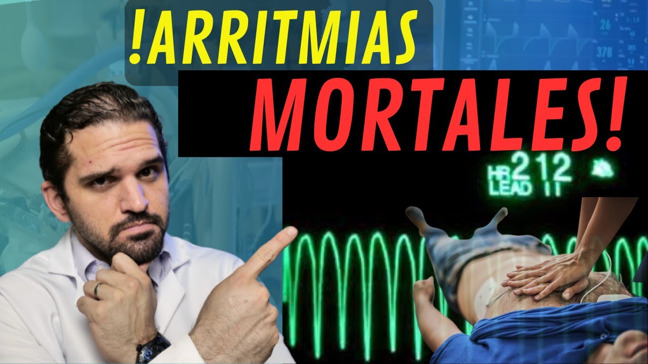 ¡MIRA! Estas son las ARRITMIAS mas PELIGROSAS y como SOSPECHARLAS ⚠