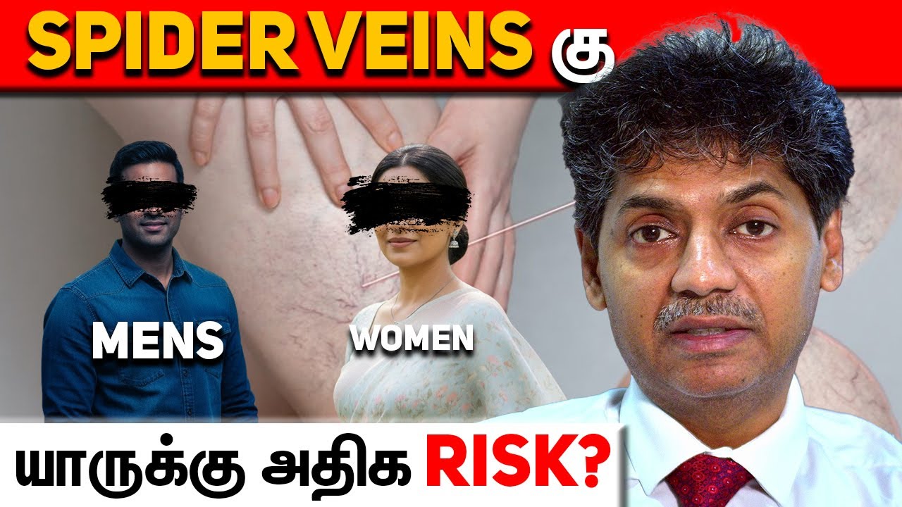 Spider Veins ku யாருக்கு அதிக Risk? Doctor Explain! | Dr Bala Kumar