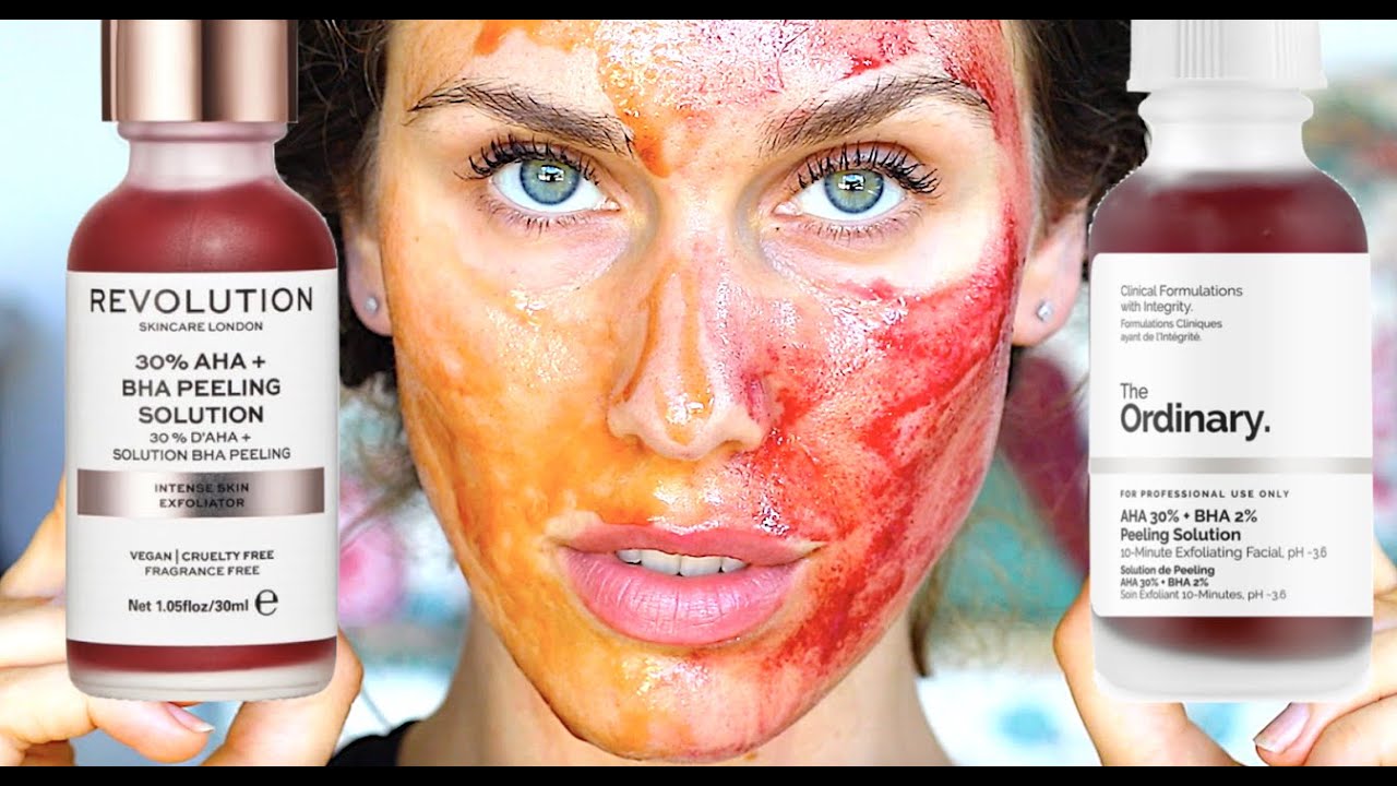 Is The Ordinary BEING REPLACED By Revolution Beauty?!?