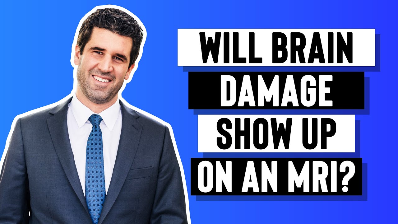 Will Brain Damage Show Up on an MRI?
