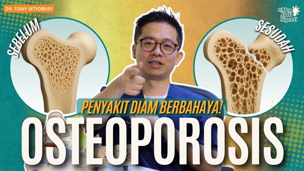OSTEOPOROSIS , PENYAKIT DIAM BERAKIBAT FATAL! | DR TONY SETIOBUDI