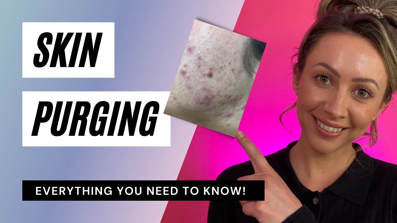 Skin Purge | HELP! What Can I Do?!