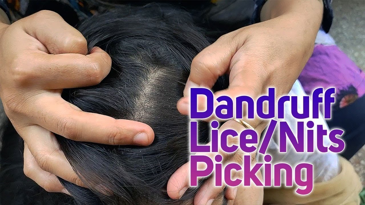 ASMR Multiple Ladies Head Lice and Nit Picking Mid Age Woman | Free Stock Footage for Youtube Videos