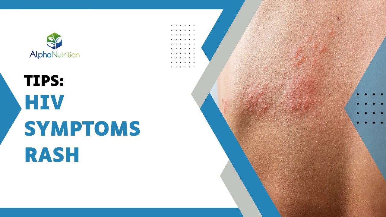 Unraveling HIV Rashes: Understanding and Managing Skin Manifestations 🤧
