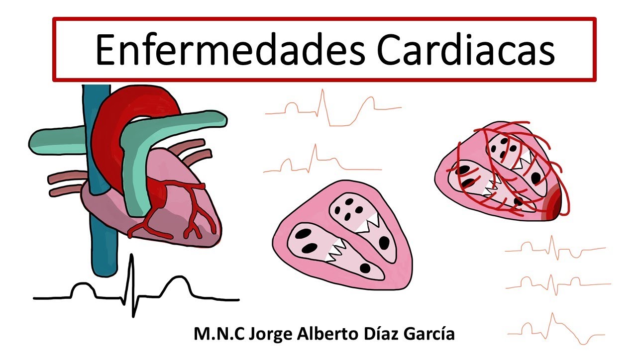 Enfermedades Cardiacas