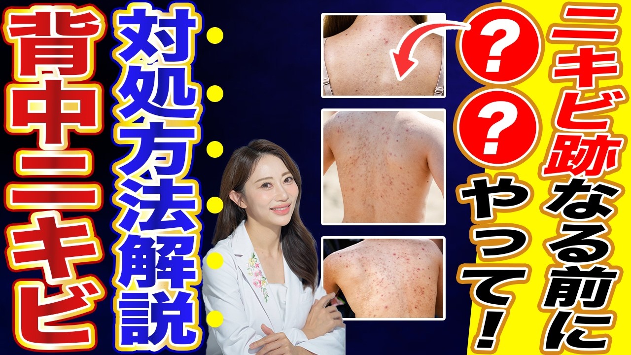 背中ニキビの原因って？背中のスキンケアとニキビ跡対策を皮膚科医が徹底解説！